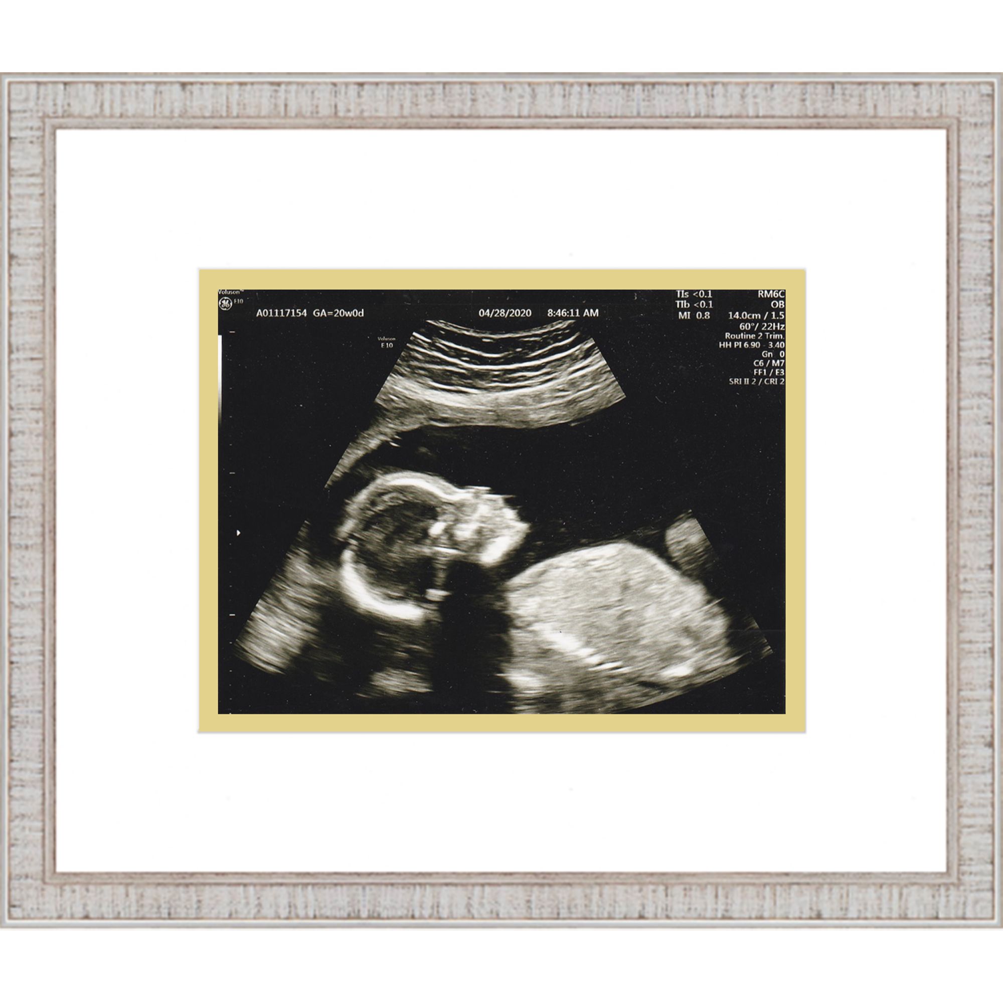 Rustic White Sonogram Frame with Double Mats Frames for Ultrasounds