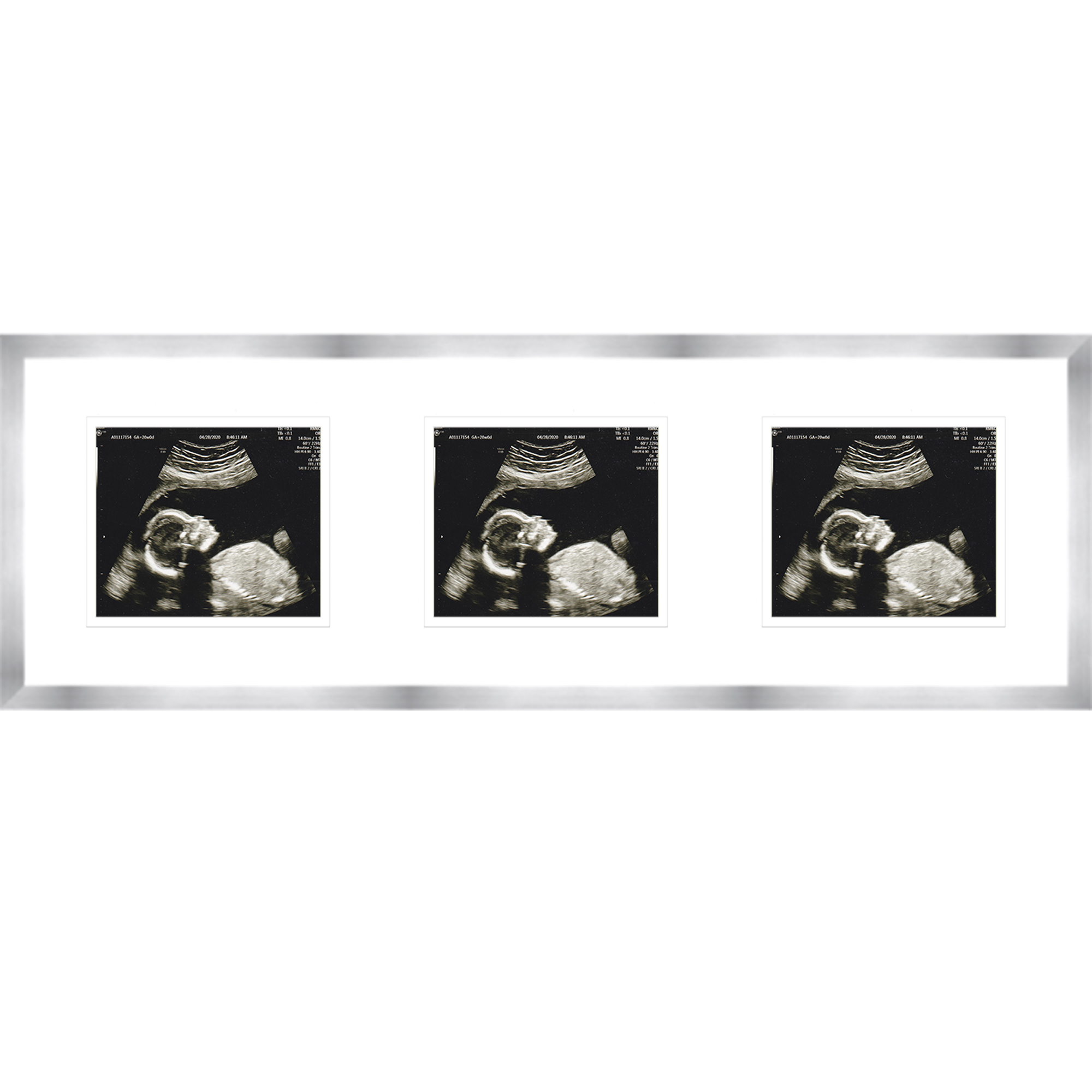 Silver Sonogram Frame with Double Mats for 3 Images Frames for